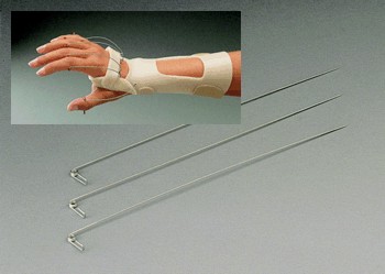 Finger extension wire assist