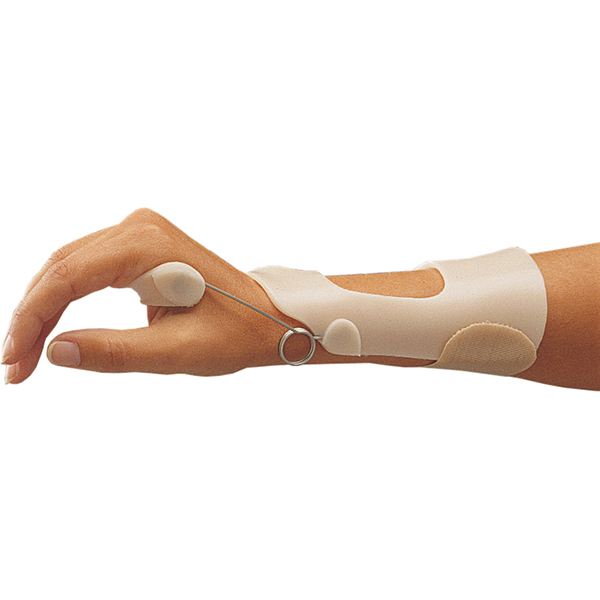 Radial wrist extension splint