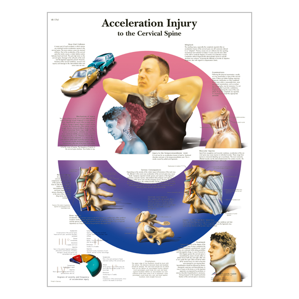 Chart "Acceleration Injury to the  Cervical Spine"