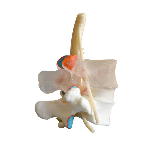 Intervertebral discs model with nerves