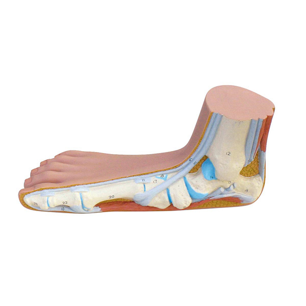 Functional fat foot model (Pes Planus)